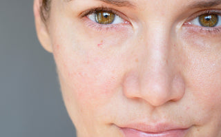 Skipping Moisturizer? Here’s Why That’s Hurting Your Skin Barrier